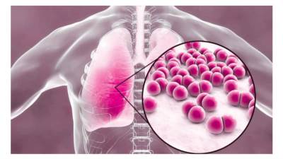 مصر تحاصر مرض الغلابة